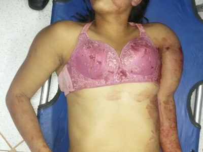 Young Colombian woman killed by stray bullet 