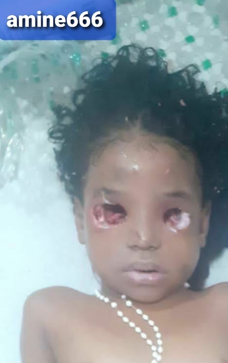 Brazilian mother kill her daughter and gouged her eyes out