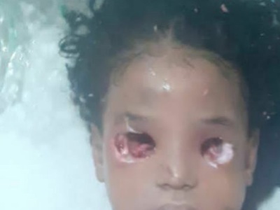 Brazilian mother kill her daughter and gouged her eyes out 