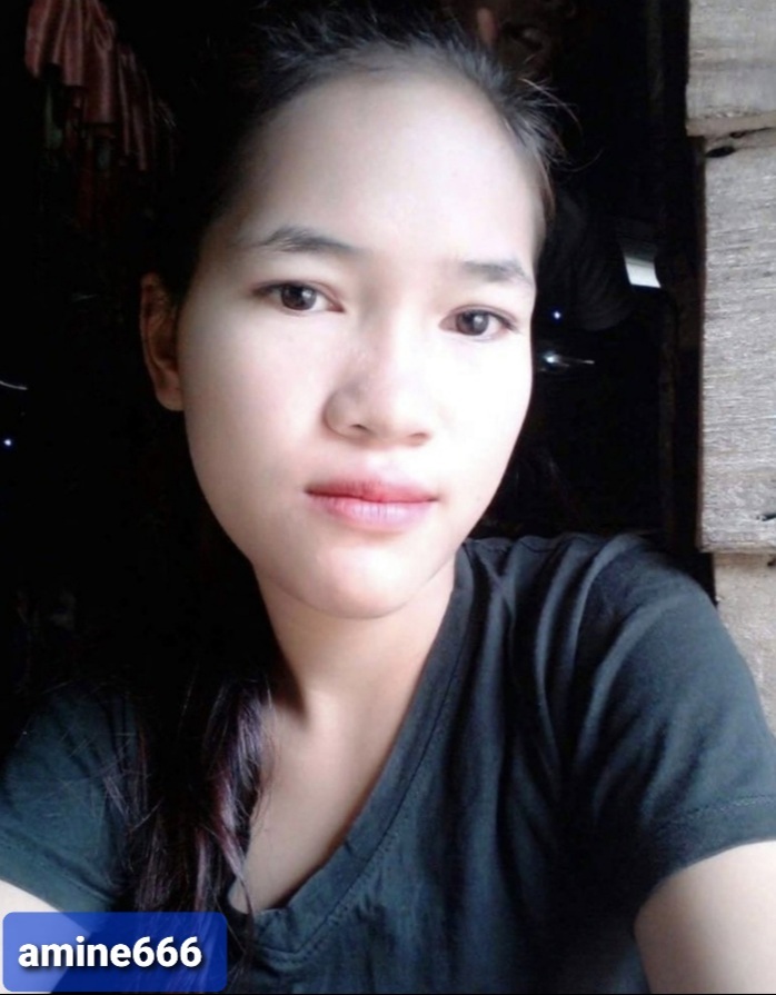 Young Indian Woman Suffering From The 'black fungus'