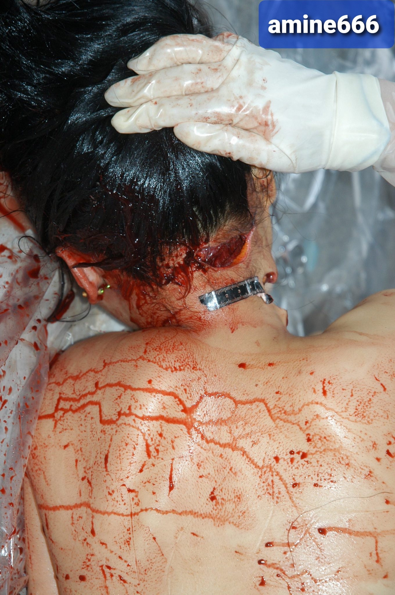 Autopsy of Chinese girl killed by cutting her throat