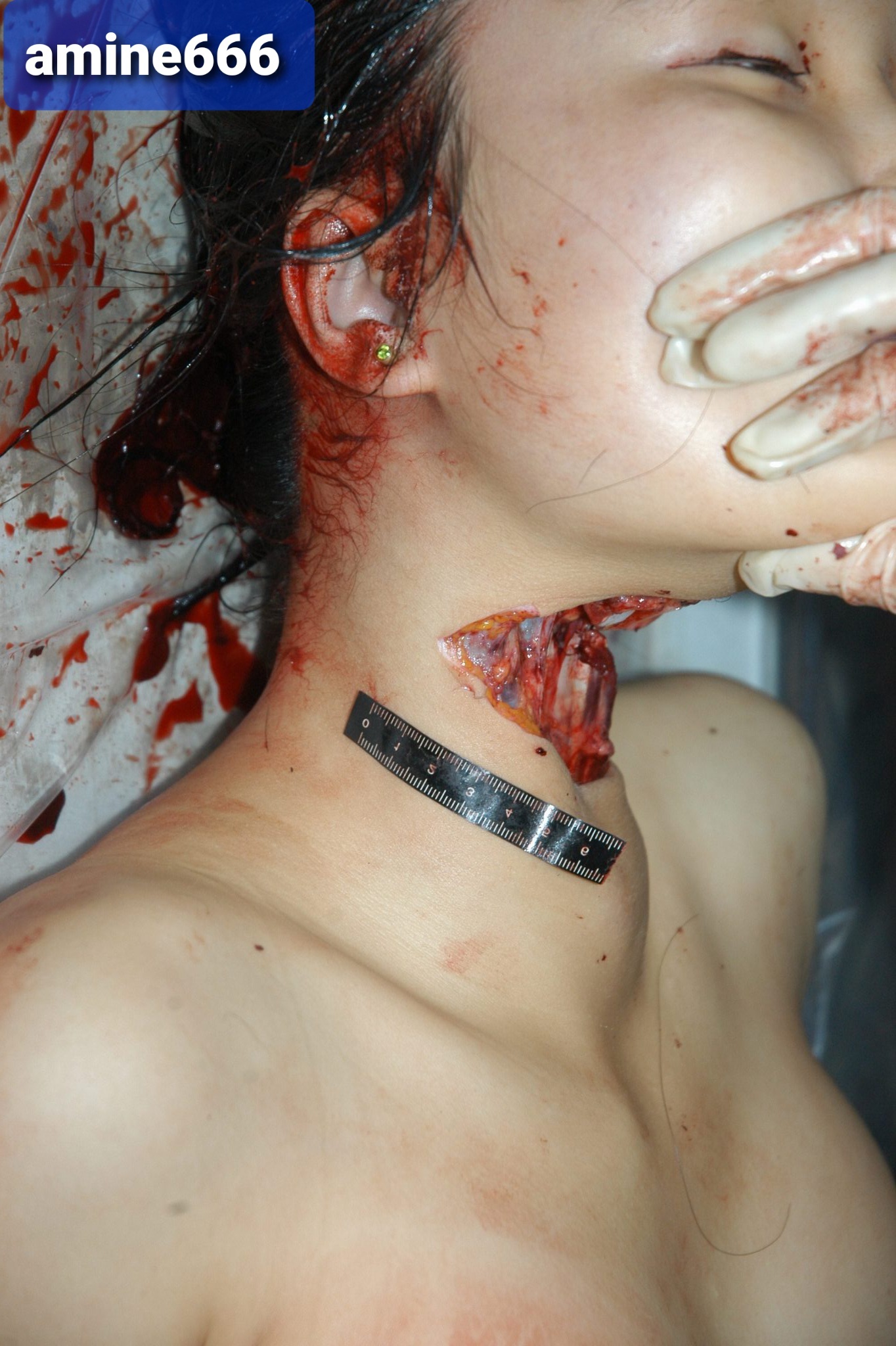 Autopsy of Chinese girl killed by cutting her throat