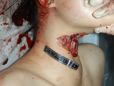 Autopsy of Chinese girl killed by cutting her throat