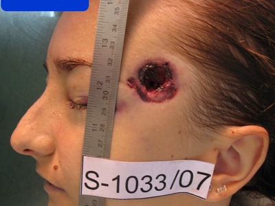 Woman killed by head shoot 