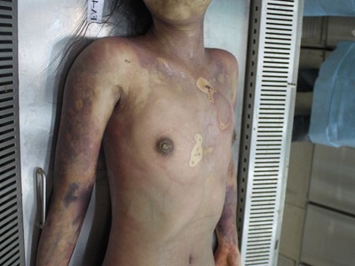 Examination nude dead corps of Chinese young women 