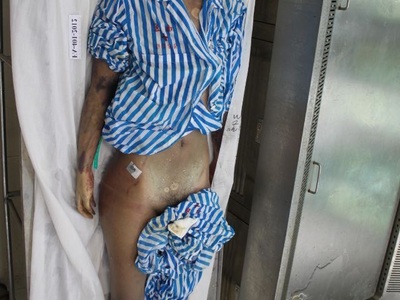 Examination nude dead corps of Chinese young women 