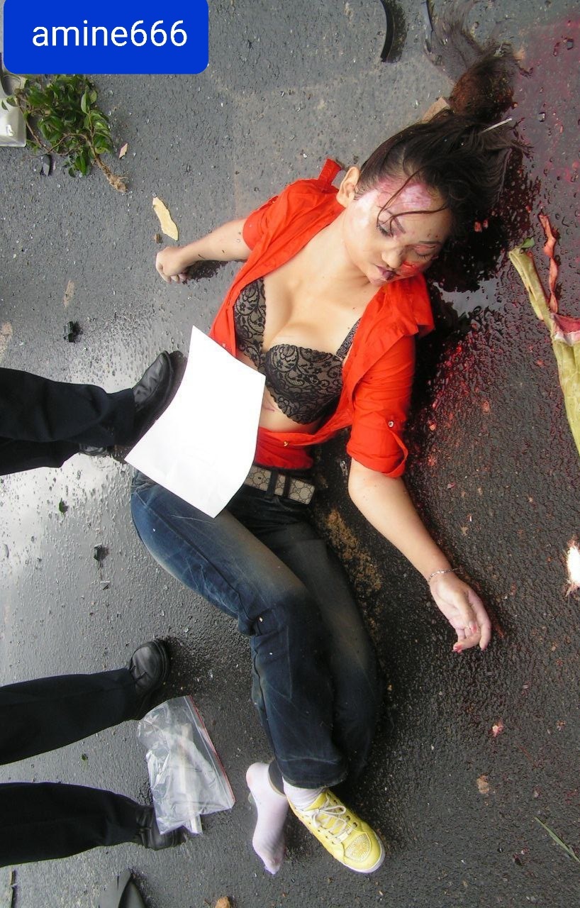 Chinese woman victime of horrific accident