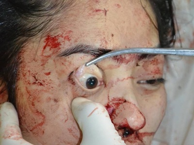 Sexy tattooed Chinese woman commit suicide by jumping from balcony 