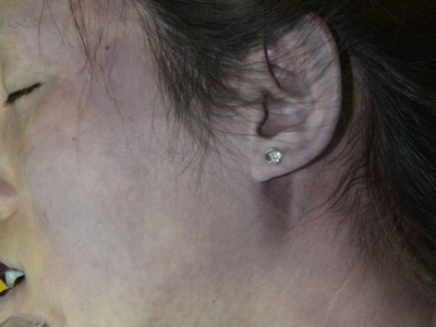 young woman died in her bed due to heart attack 