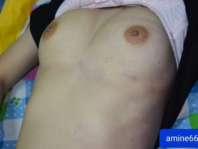 young woman died in her bed due to heart attack 