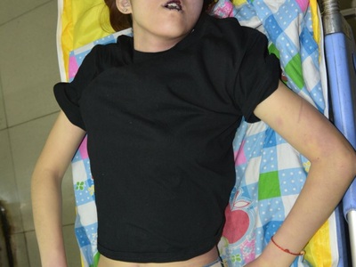 young woman died in her bed due to heart attack 