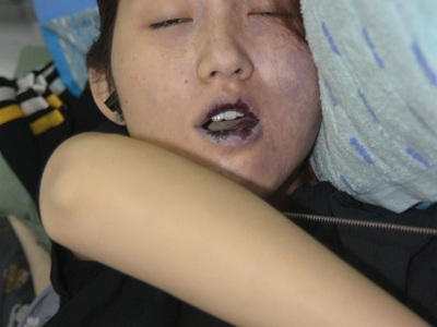 young woman died in her bed due to heart attack 