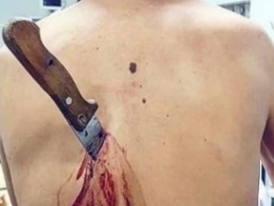 Old man stabbed by his old wife and still alive 