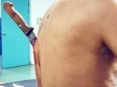 Old man stabbed by his old wife and still alive 