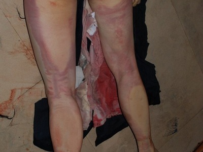 Chinese prostitute butchered by meat cleaver 