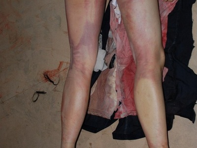Chinese prostitute butchered by meat cleaver 