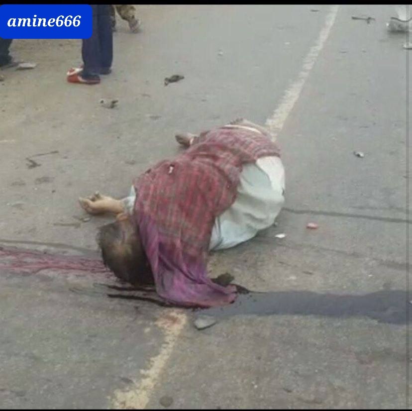 Man died in horrific accident his face removed from his place