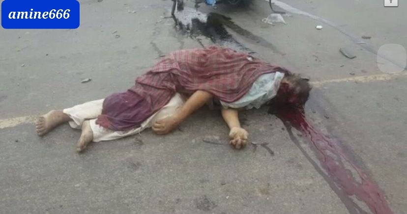 Man died in horrific accident his face removed from his place