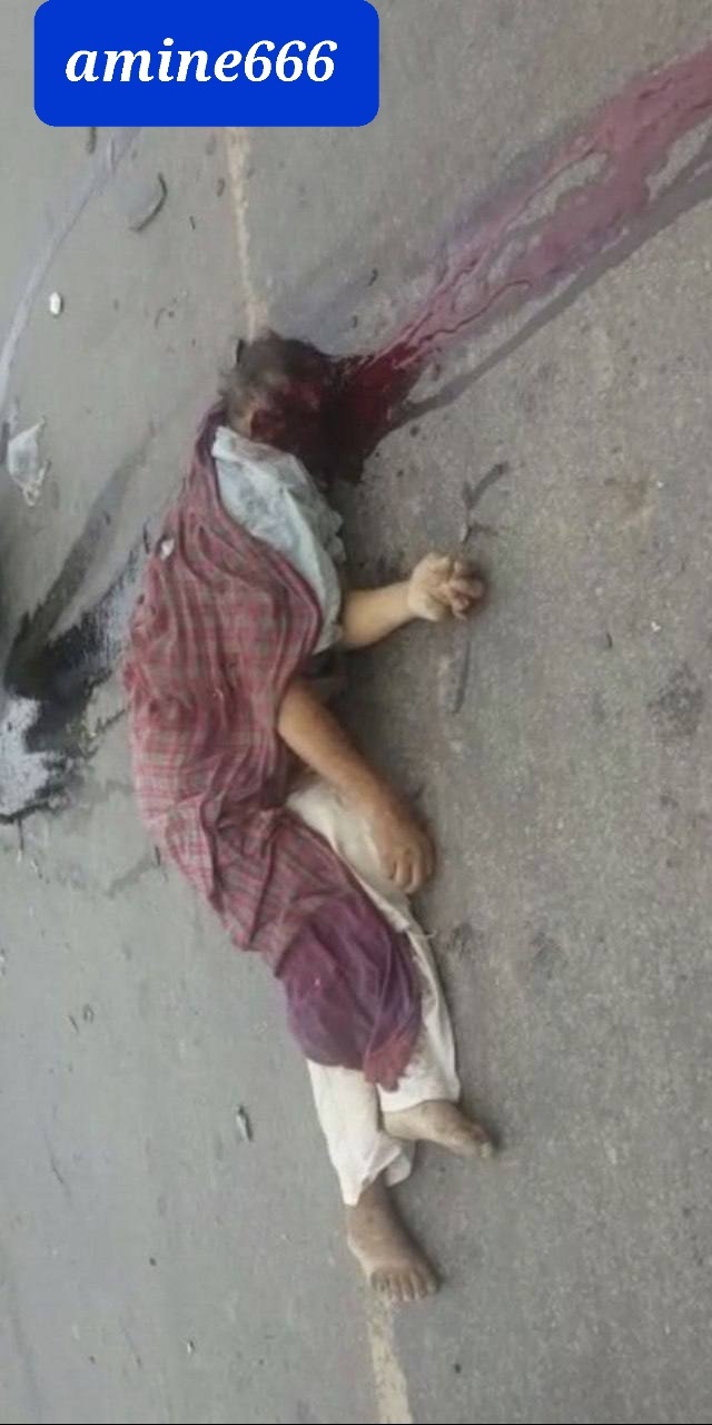 Man died in horrific accident his face removed from his place