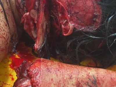 Haitian woman gored byhusband forfucking another man whenhewas jailed 