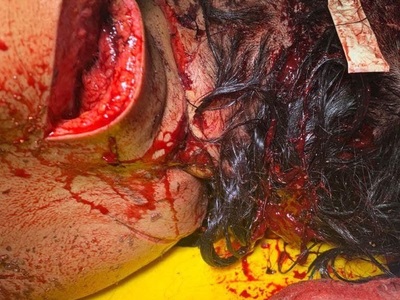 Haitian woman gored byhusband forfucking another man whenhewas jailed 