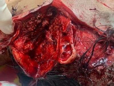 Haitian woman gored byhusband forfucking another man whenhewas jailed 