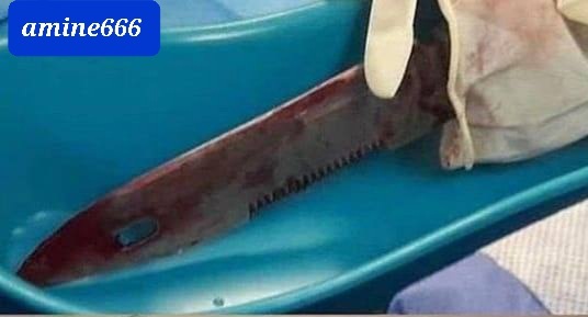 Jordanian military officer accidentally had a knife stuck in his eye