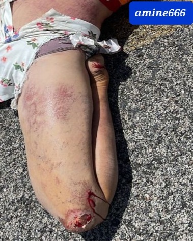 Brazilian woman victime of deadly motorcycle crash