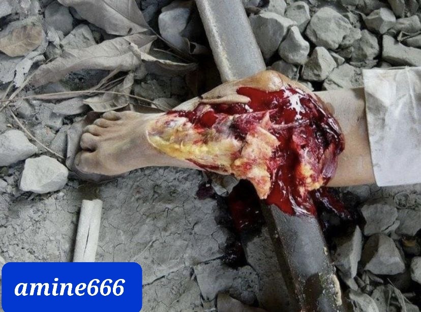 Deaf old woman crushed under train