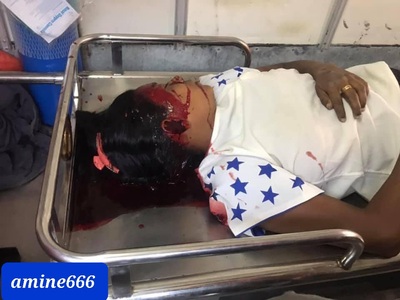 Young woman killed by stray bullet to the head