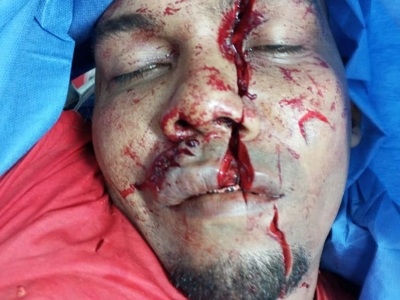 Haitian machete attack victim