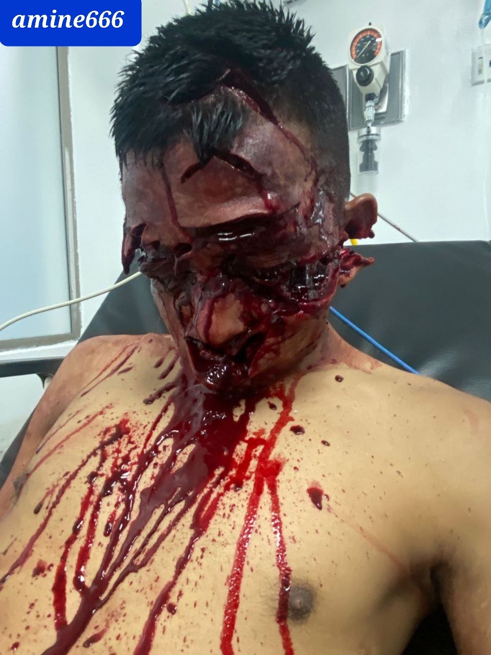 Machete Deaths are the Worst Deaths (Aftermath)