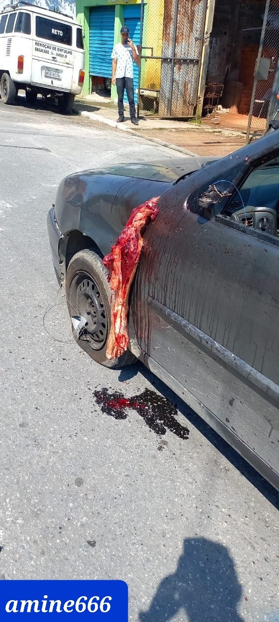 Motorcyclist lost his leg and still alive