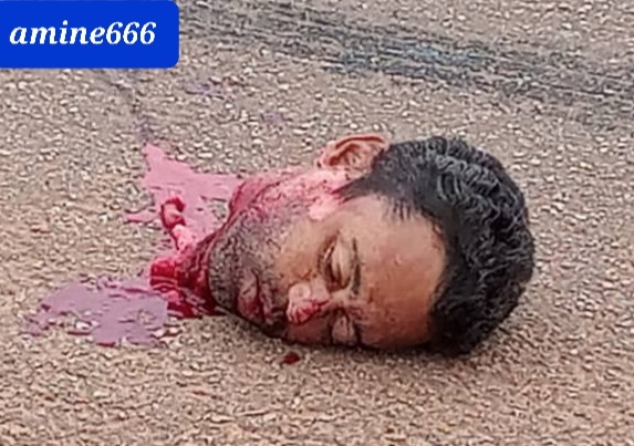 Colombian man beheaded and have his body crushed under truck