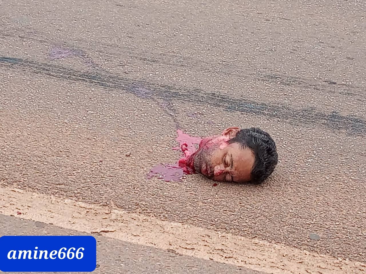 Colombian man beheaded and have his body crushed under truck