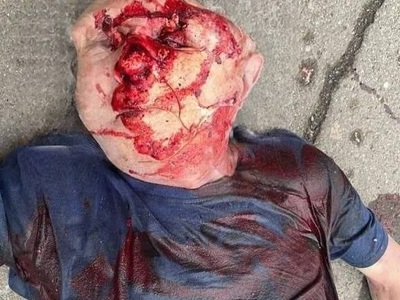 Old man lost the half of his head in horrific car crush