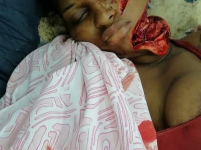 Woman Hacked to Death by Machete