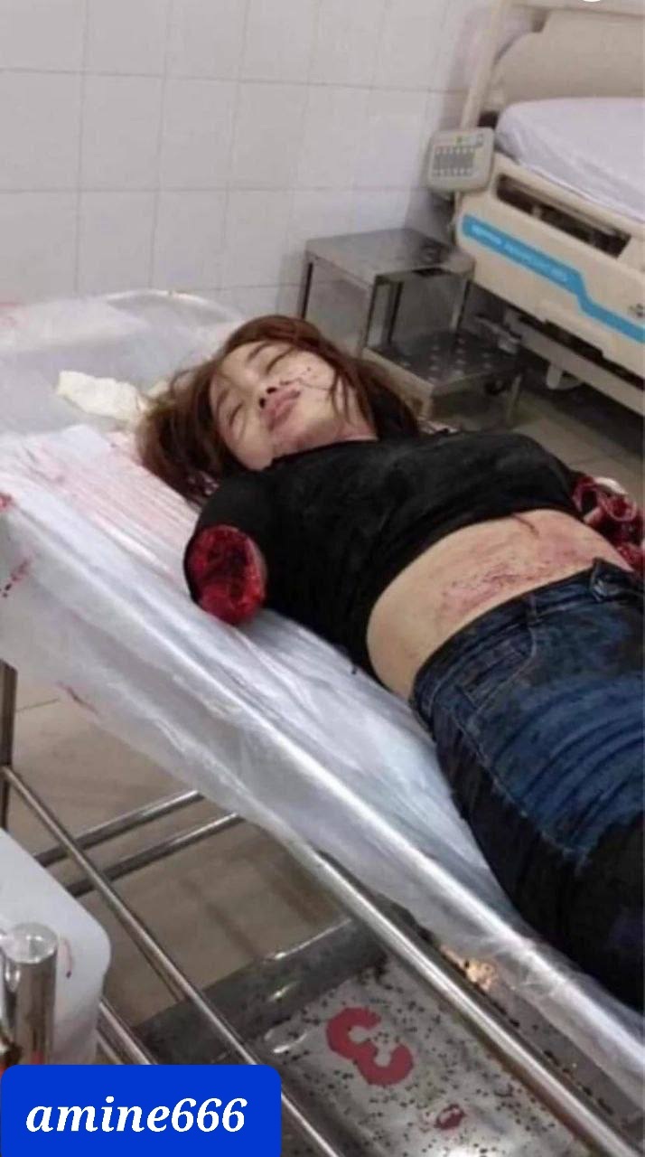 Cute Girl Loses Her Arm in Deadly Accident.