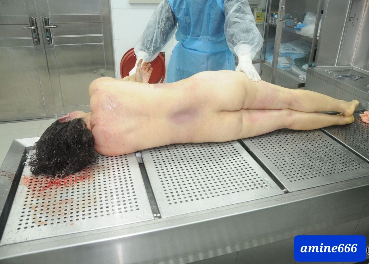 Examination a nude dead corps of ugly Chinese women