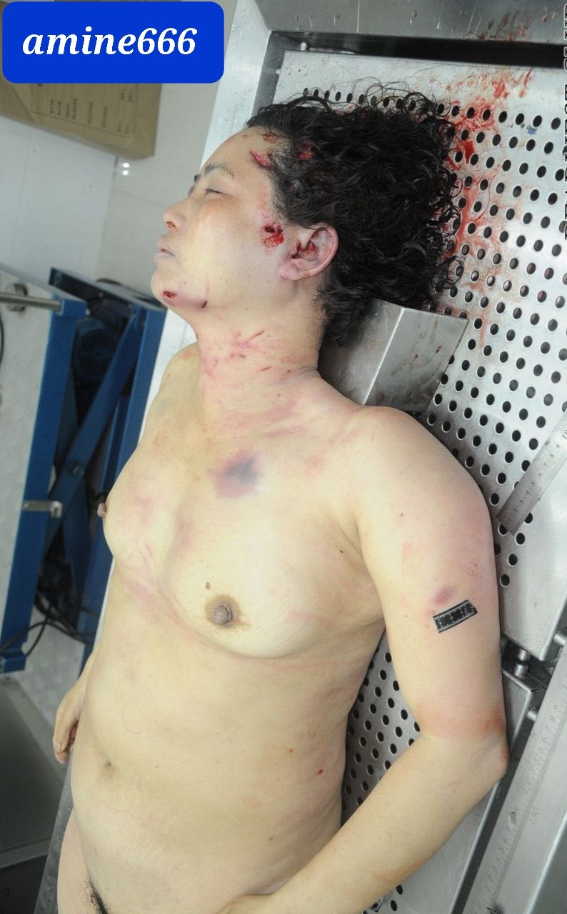 Examination a nude dead corps of ugly Chinese women