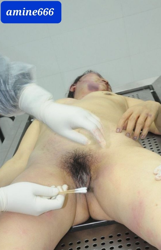 Examination a nude dead corps of ugly Chinese women