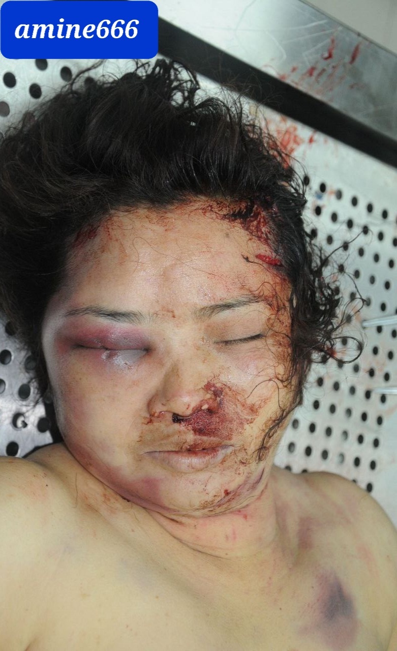 Examination a nude dead corps of ugly Chinese women