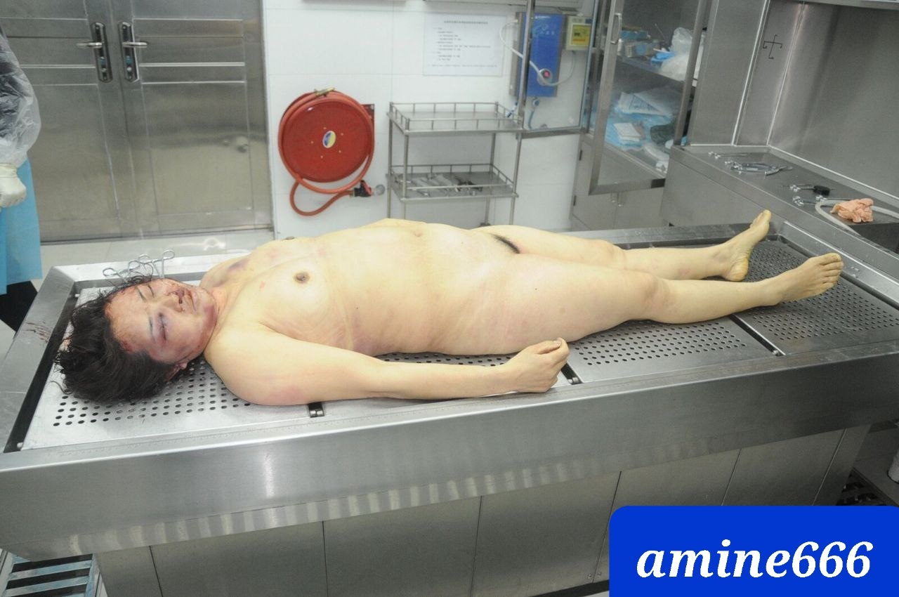 Examination a nude dead corps of ugly Chinese women