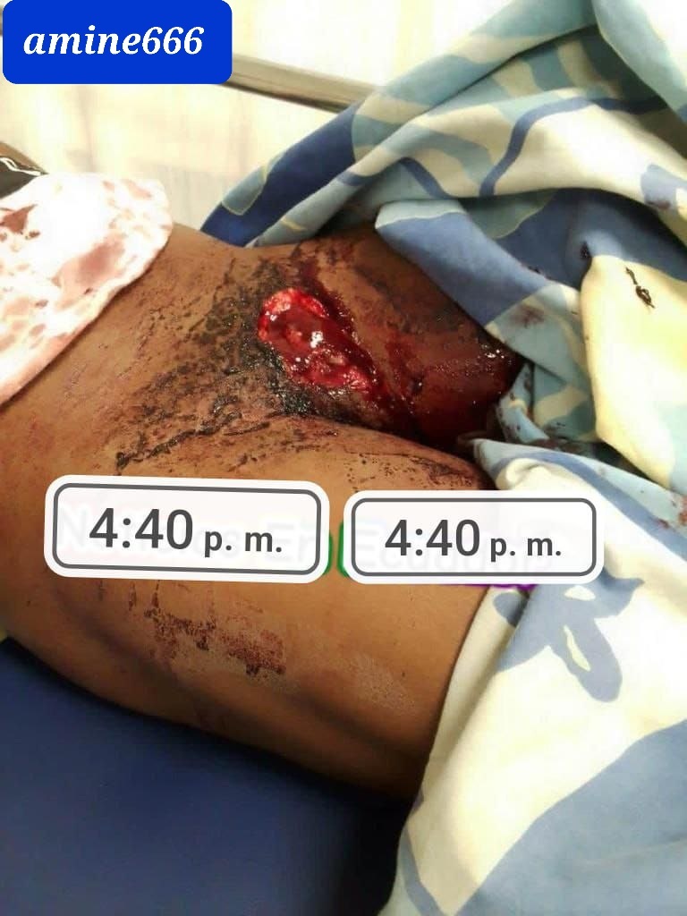 Woman Drugged Then Castrated her Cheating Husband.