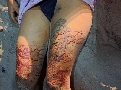 Hooker killed and dumped in abandoned road