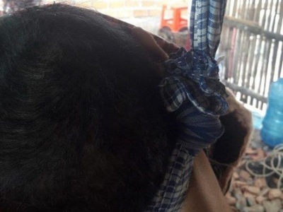 Young man with mouth cancer had enough and commit suicide