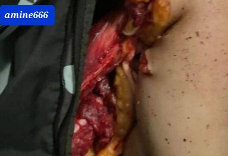 Sexy Woman Totally Dismembered by her Ex...