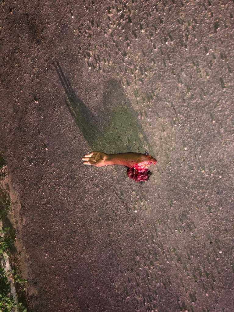 ACCIDENT ..with fatal victim