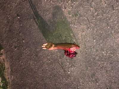 ACCIDENT  ..with fatal victim