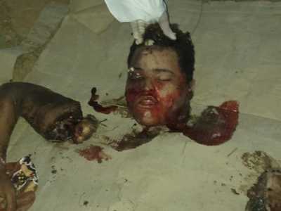 The police locate the dismembered body in CabrobÃ³, Brazil